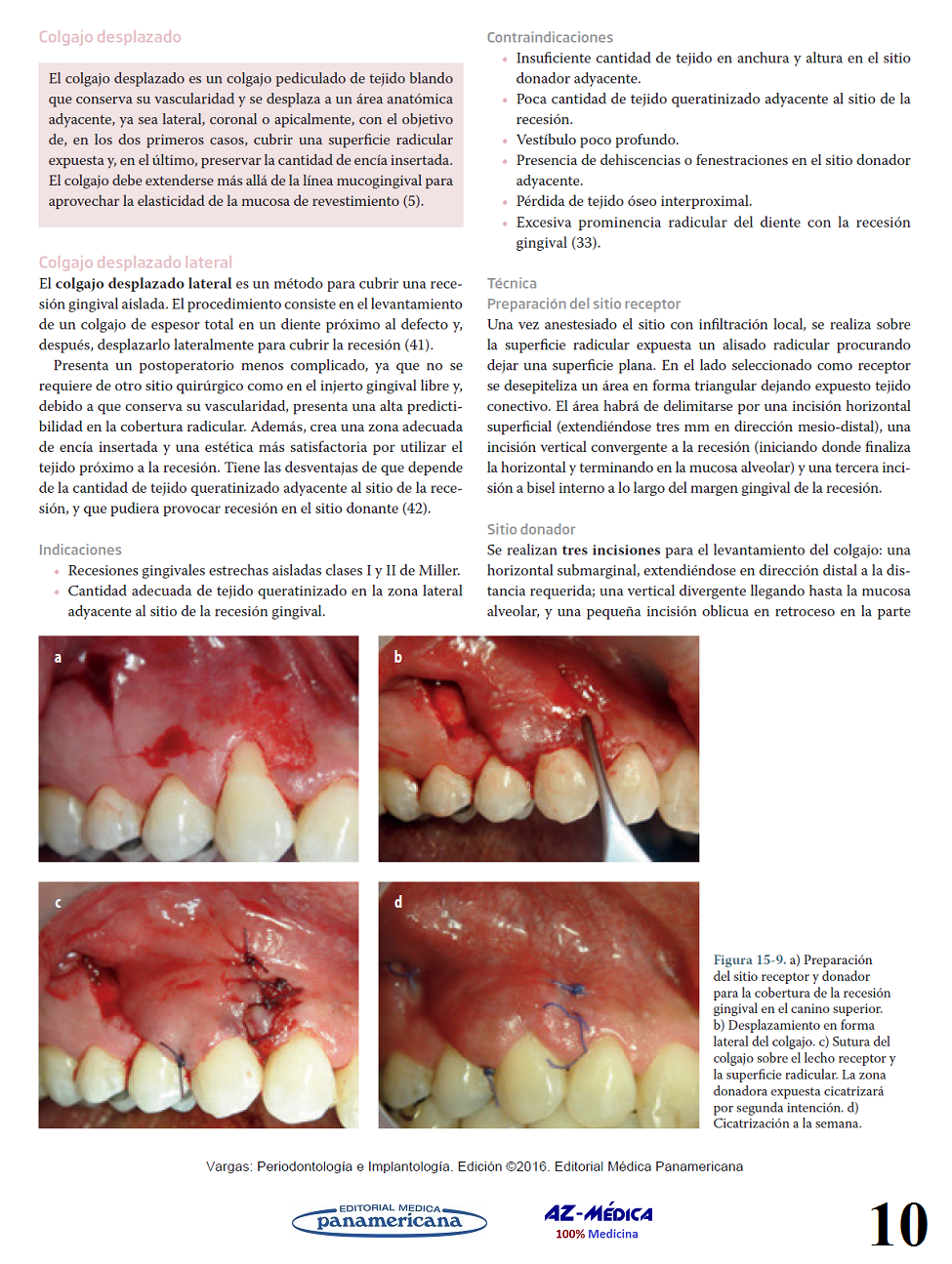 Cirugía Plástica Periodontal - Fuente:  Periodontología e Implantología - Vargas Casillas - 9786079356910